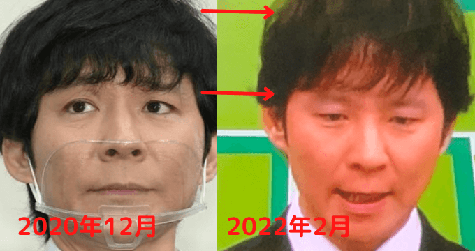 2020年12月と2022年2月渡部健の髪の毛の変化