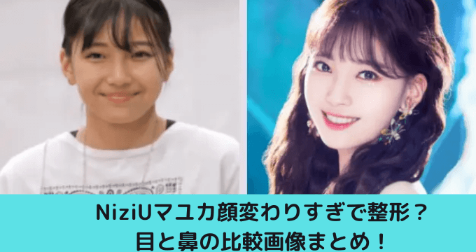 Niziuマユカ顔変わりすぎで整形 目と鼻の比較画像まとめ ゆごてん Niziuマユカ顔変わりすぎで整形 目と鼻の比較画像まとめ ゆごてん