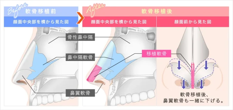 宮脇咲良